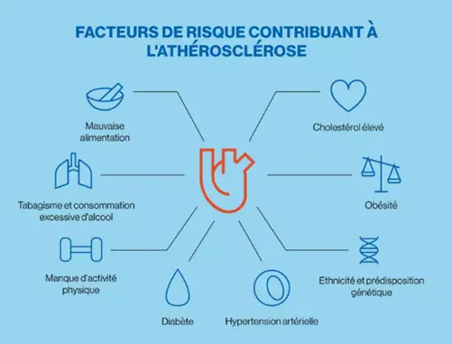 Infographic - les facteurs de risque cardiovasculaires 