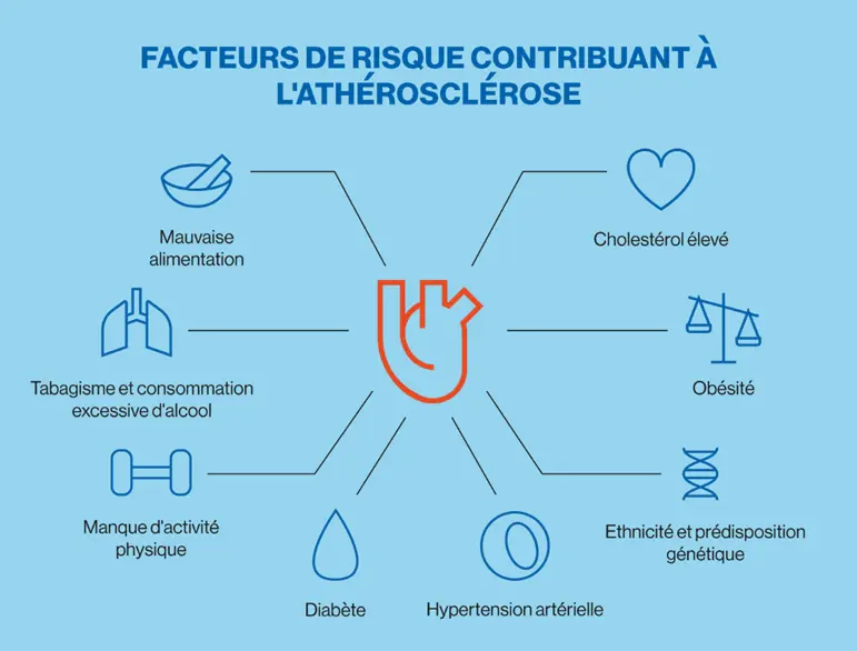 Infographic maladies cardiovasculaires