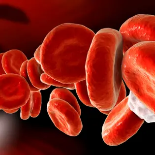 Полицитемия вера