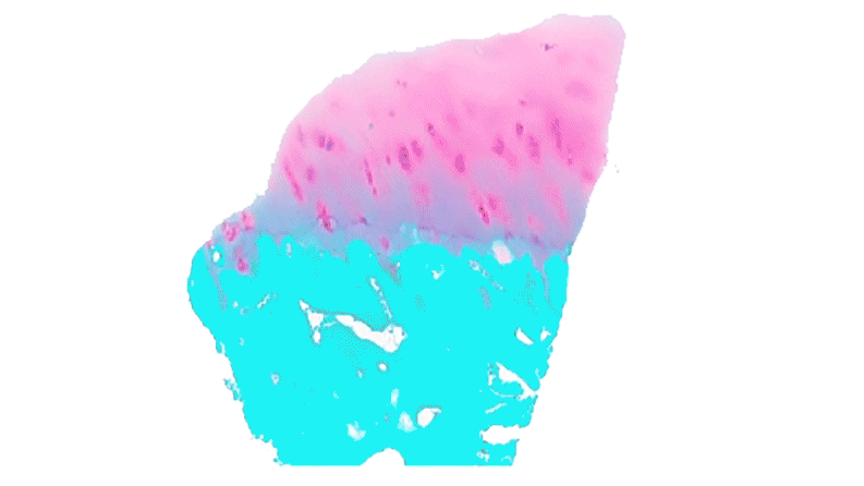 Eine Gewebeprobe gibt Aufschluss über Proteine im Knorpel