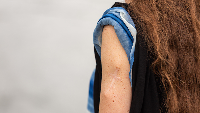 Des traces d’une intervention potentiellement mortelle: Natascha revendique ses cicatrices.)