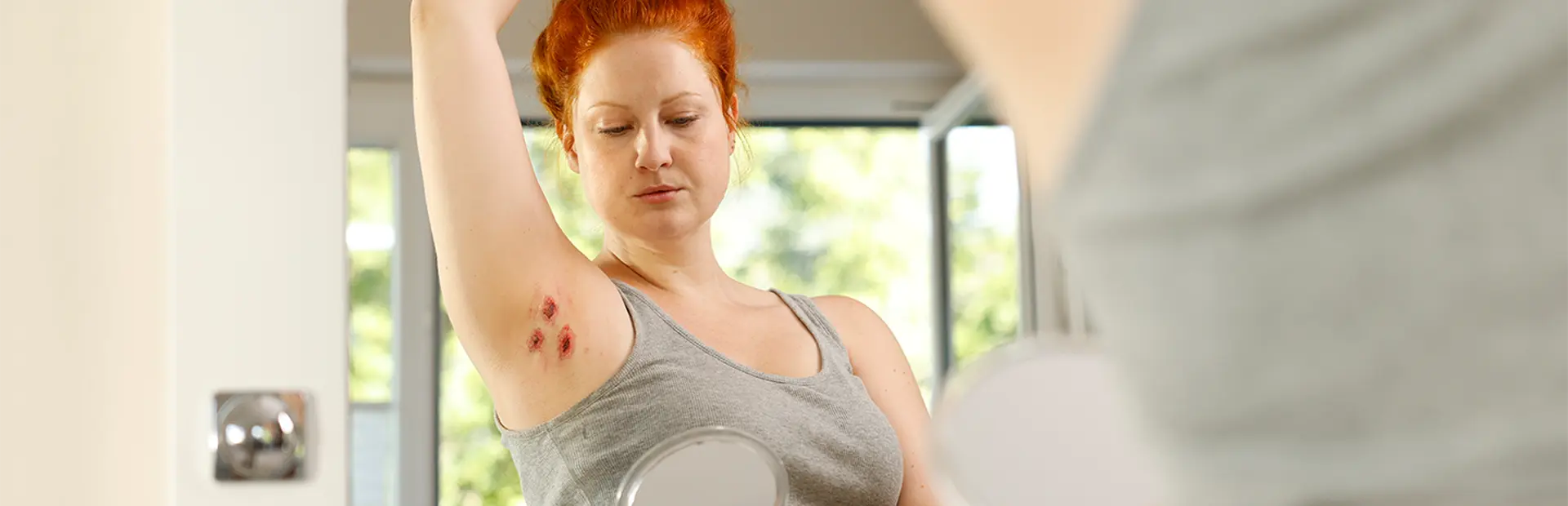Eine Frau schaut sich im Spiegel betroffene Stellen in der Achselhöhle an