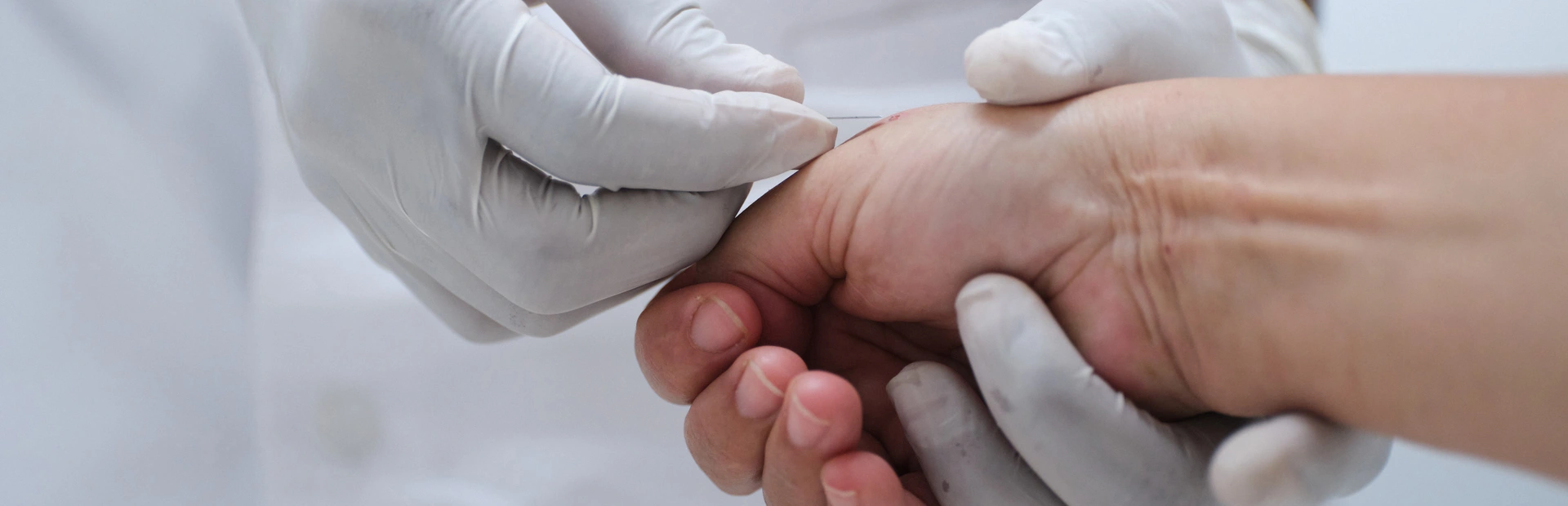 Arzt nimmt Blutproben von einem Patienten