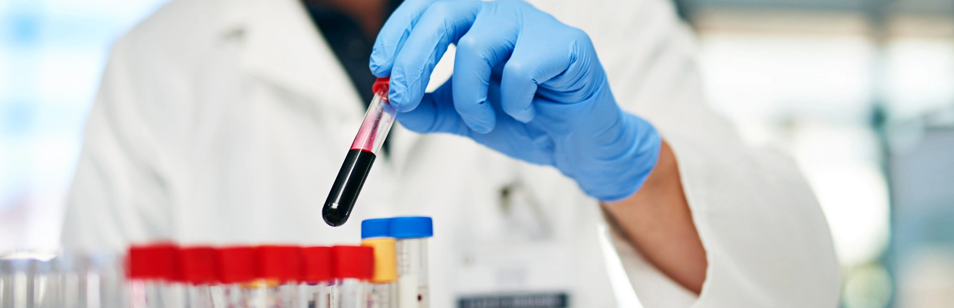 Ein Arzt im Labor, der mit Blutproben arbeitet