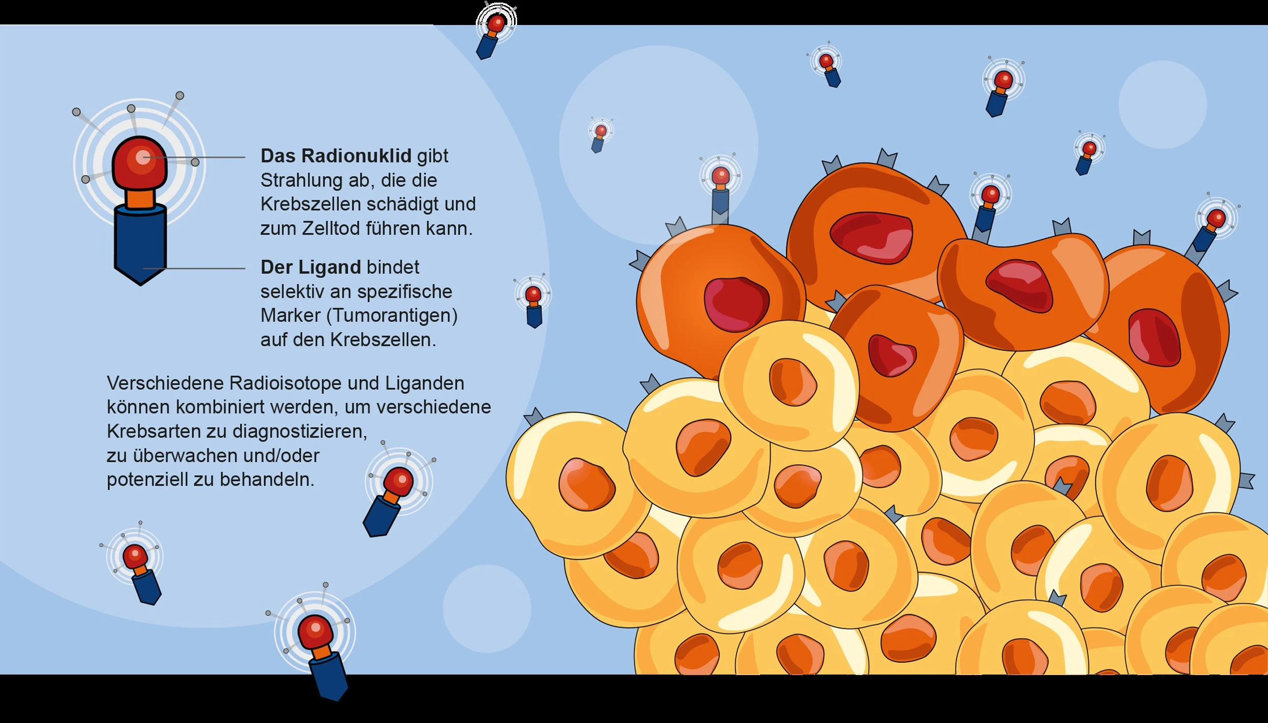 Bei der Radioligandentherapie handelt es sich um eine Präzisionskrebsbehandlung, bei der ein zielgerichtetes Biomolekül (Ligand) mit einem Radionuklid (eine instabile Atomsorte, die beim spontanen Zerfall radioaktive Strahlung aussendet) kombiniert wird. 