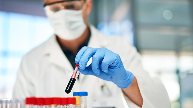 Ein Arzt im Labor, der mit Blutproben arbeitet Ein Arzt im Labor, der mit Blutproben arbeitet