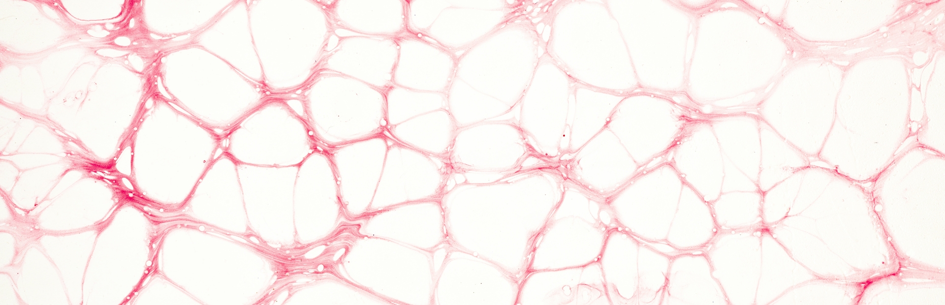 Imagen de la estructura de un tumor