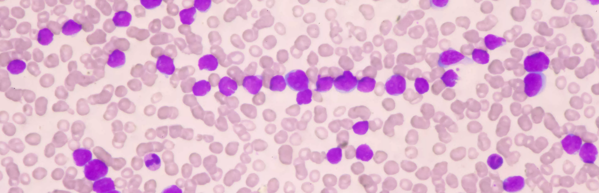 Imagen microscópica de leucocitos