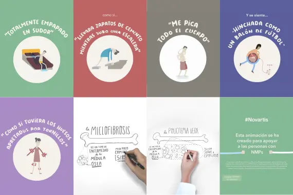 Síntomas de las MPN