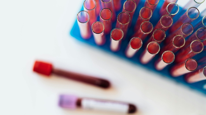 Tubos de ensayo con muestras de sangre