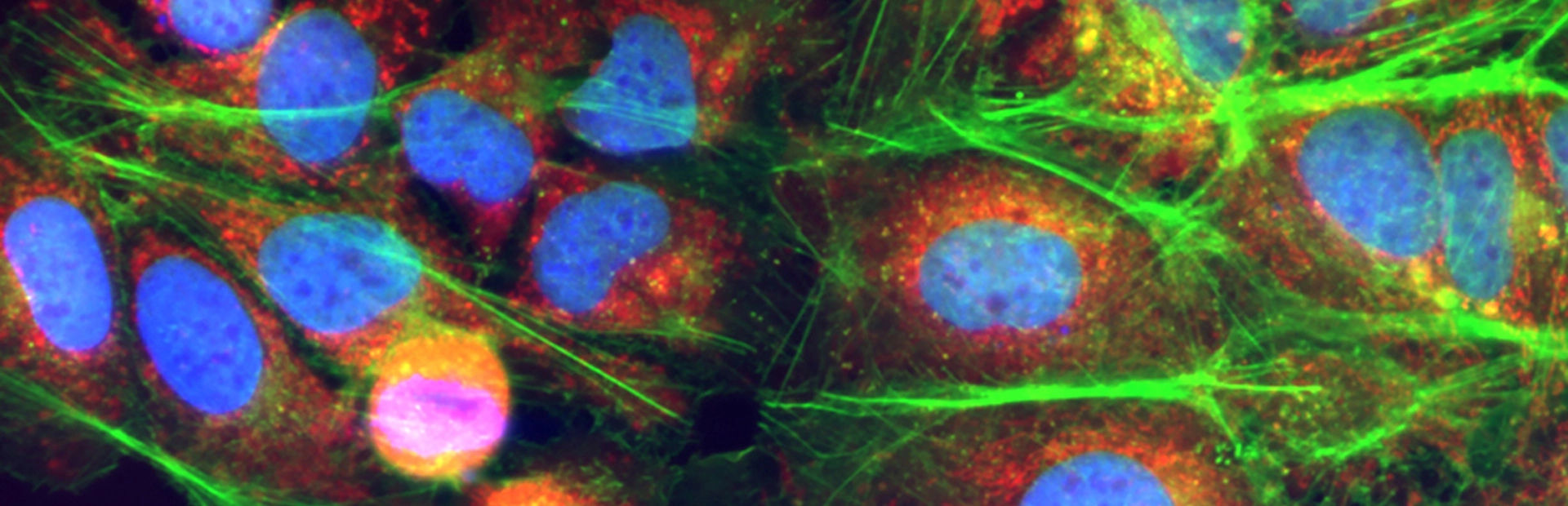UP 4 cell and gene header
