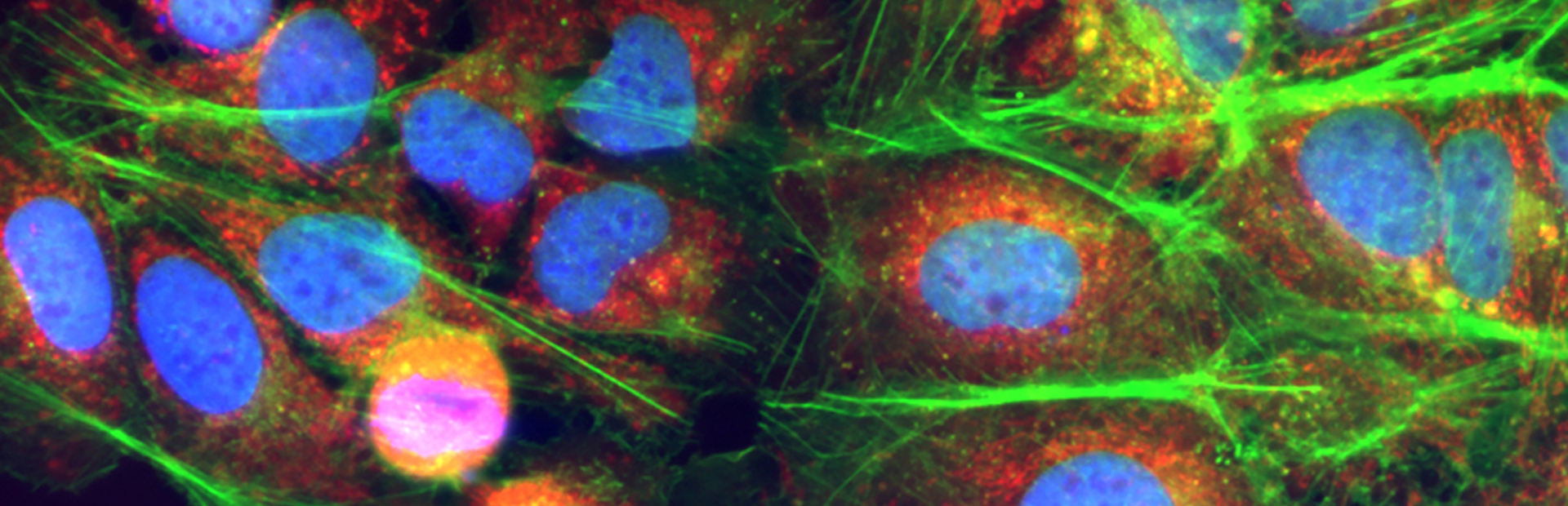 UP 4 cell and gene header