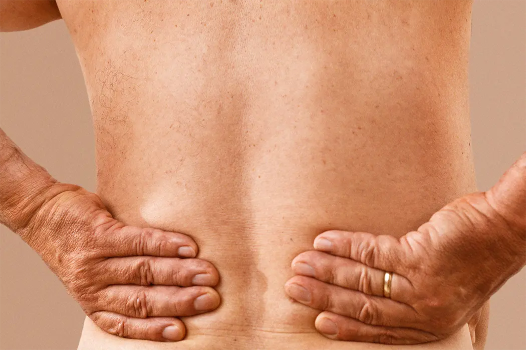 Aksiaalisen spondylartriitin hoito