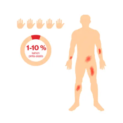 Lievä psoriasis