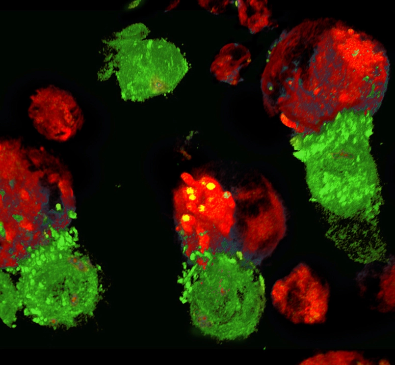 次世代CAR-Tへの挑戦