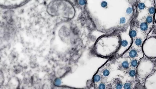 Coronavirus under the microscope