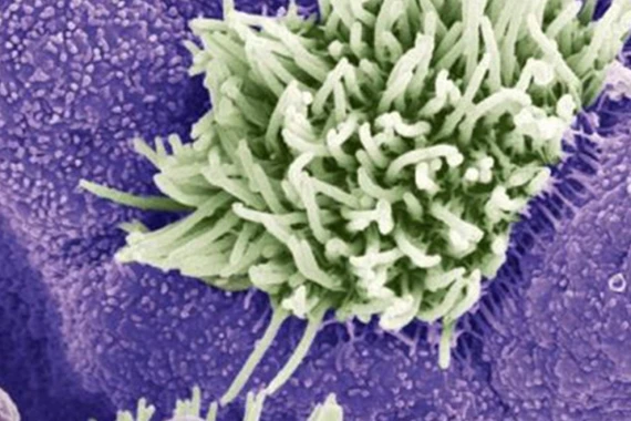 Boli Respiratorii Novartis Romania