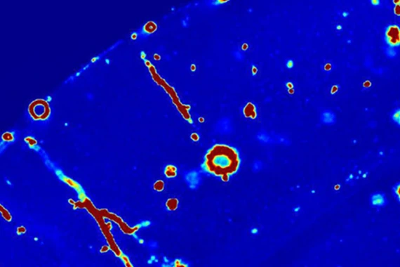 Neurologie Novartis Romania