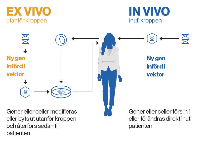 Förenkling av hur processen för behandling med cell- och genterapier går till, i och utanför kroppen. Illustration.