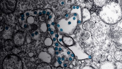 Coronavirus
