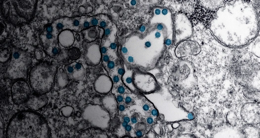 Coronavirus