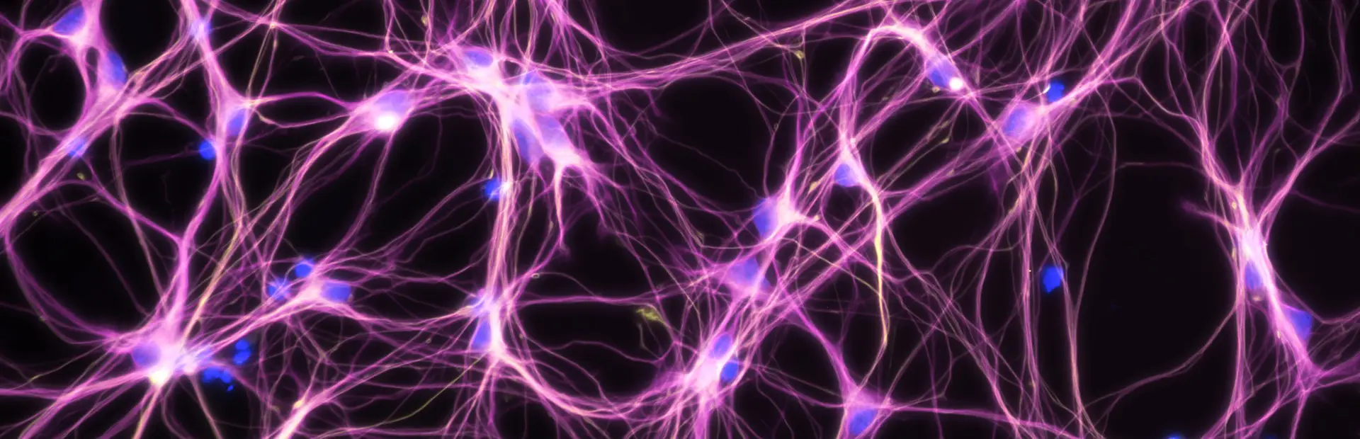 Neuron image from Novartis SciArt collection, courtesy of Alan Abrams