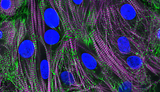 Heart muscle cells.
