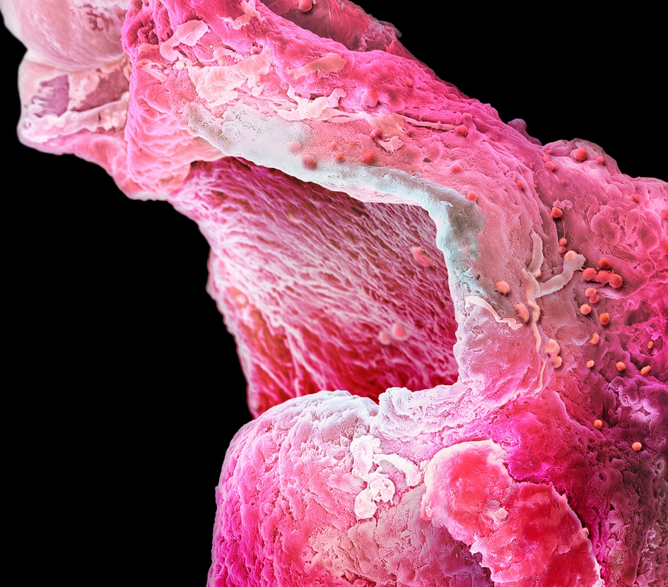 High resolution picture of an artificial heart muscle from a research lab in Cambridge.