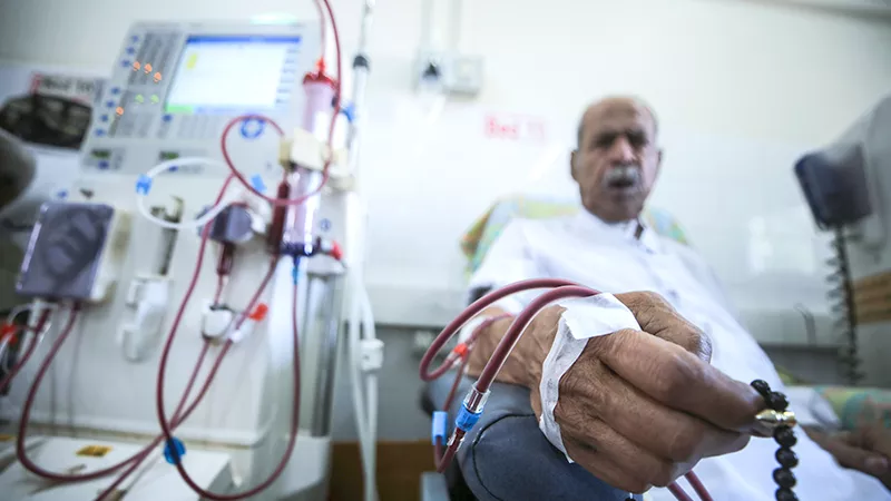 Kidney patient undergoing dialysis