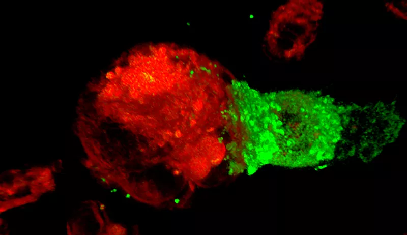 T-cells, the soldiers of the immune system (shown in green), launching an attack on cancer cells (shown in red).