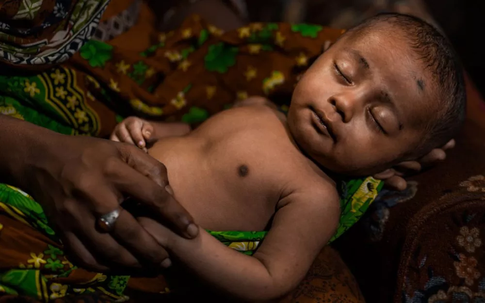 Six-month-old Foysal received treatment for pneumonia at a clinic and hospital in the capital of Bangladesh.