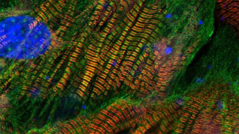 Heart muscle cells.