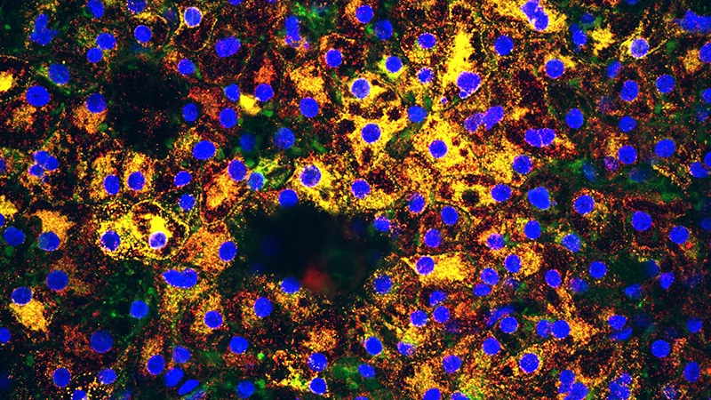 Liver cells derived from induced pluripotent stem cells.