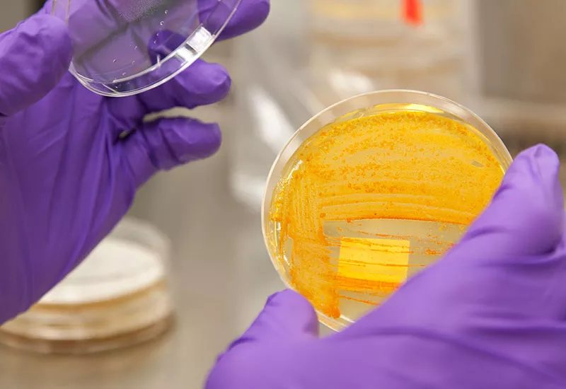 Bacteria in petri dish 