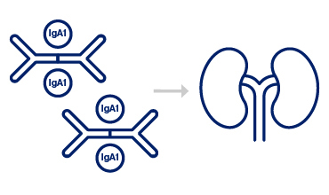 IgA1-containing immune complexes depositing in the kidneys