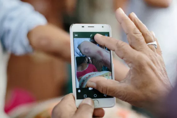 Leprosy diagnosis using a smartphone