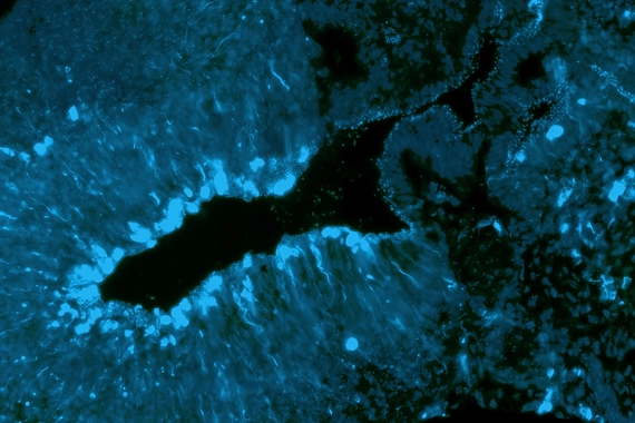 Microscopic brain organoid macro