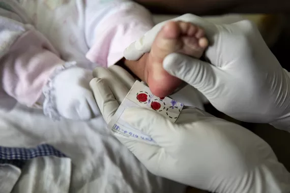 Doctor making a screening on a newborn foot