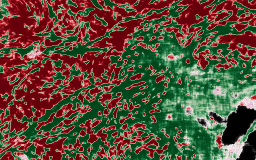 AI image overlay of pathology image