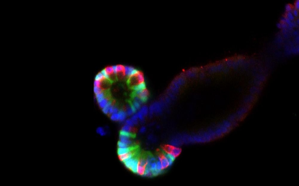 Mini-guts mimic the intestine in form and function. The green staining marks stem cells and the red staining marks Paneth cells, which provide a niche to support the stem cells