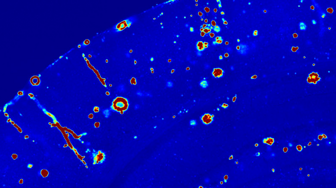 Getting down to the roots of Alzheimer’s disease Getting down to the roots of Alzheimer’s disease