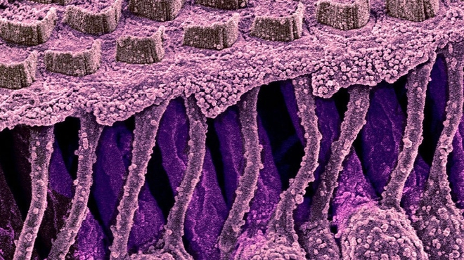 Hair cells
