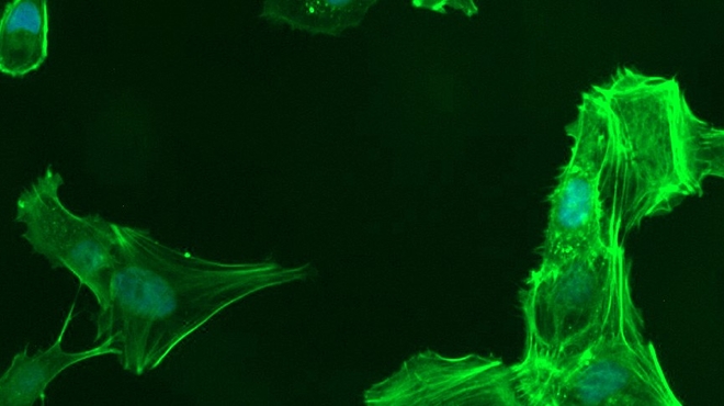 Trabecular meshwork cells Trabecular meshwork cells