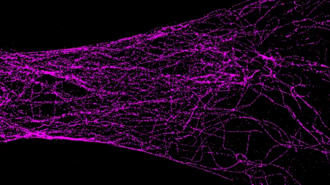 Super-resolution techniques reveal tubulin proteins (purple) in a neuron.