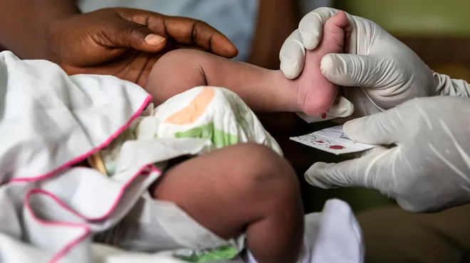 A sickle cell screening program for newborns at Kumasi General Hospital