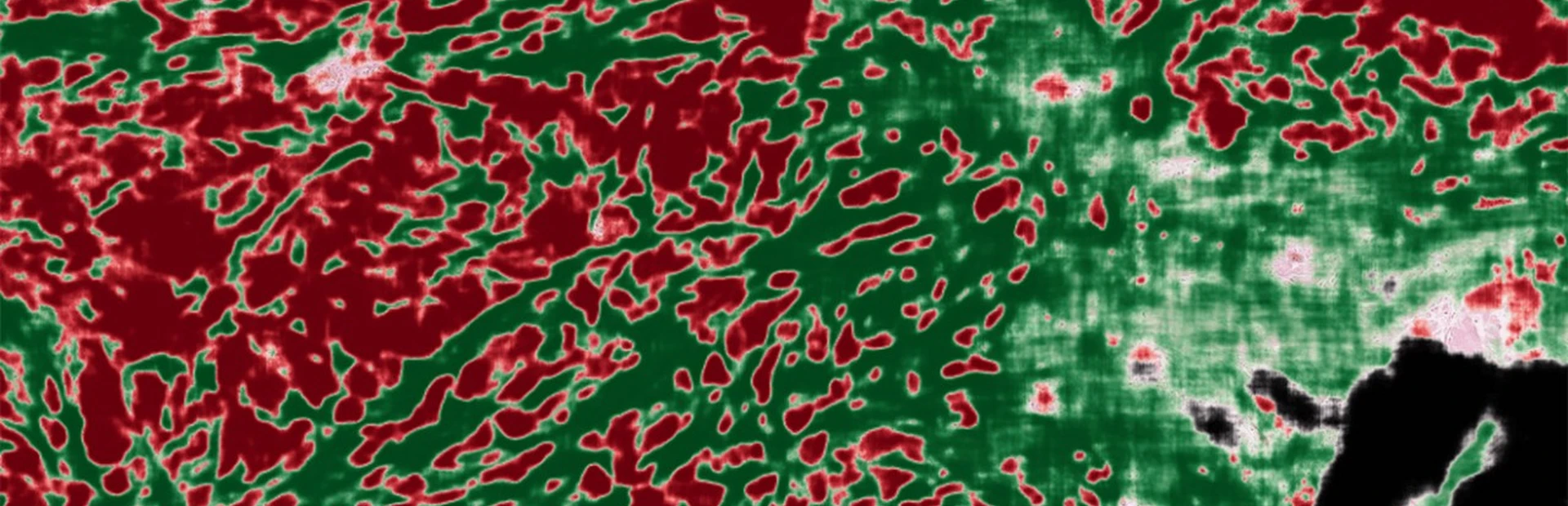 AI image overlay of pathology image