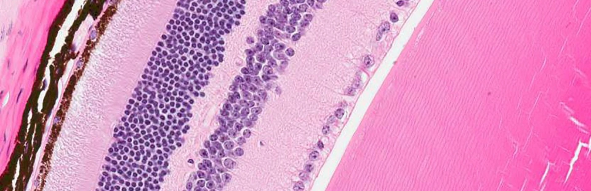 Retina cells, including some targeted by a gene therapy