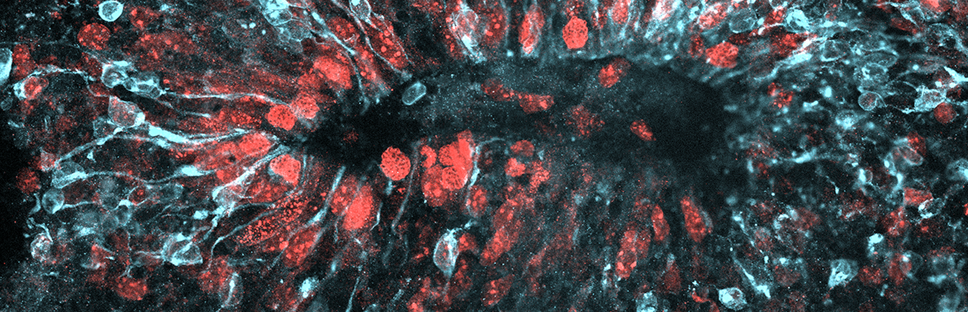 How Zika infects the growing brain