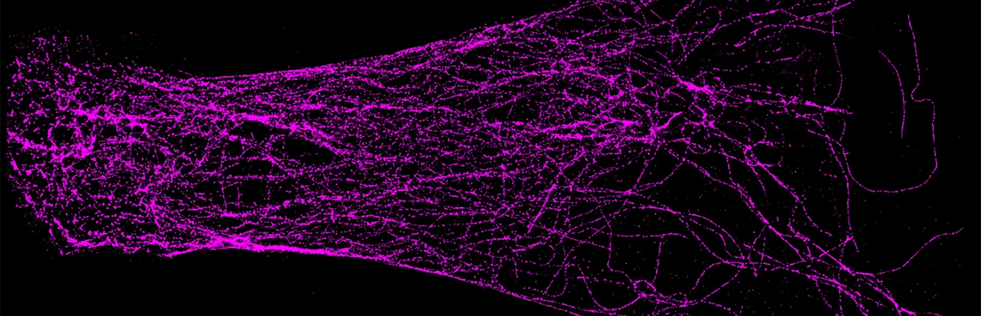 Super-resolution techniques reveal tubulin proteins (purple) in a neuron.