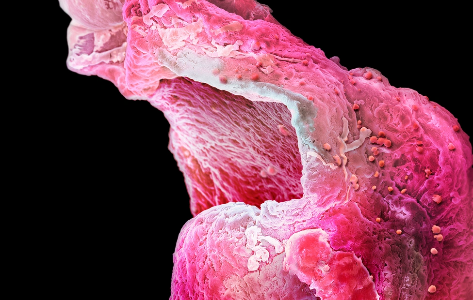 High resolution picture of an artificial heart muscle from a research lab in Cambridge.